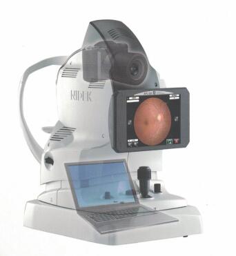 尼德克自動免散瞳眼底照相機AFC-330