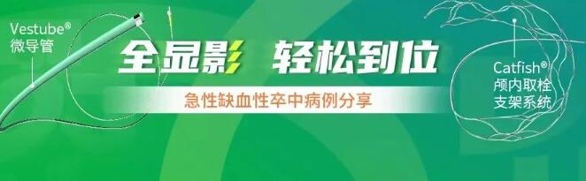 久事 顱內取栓支架系統RE-3-20/RE-4-20